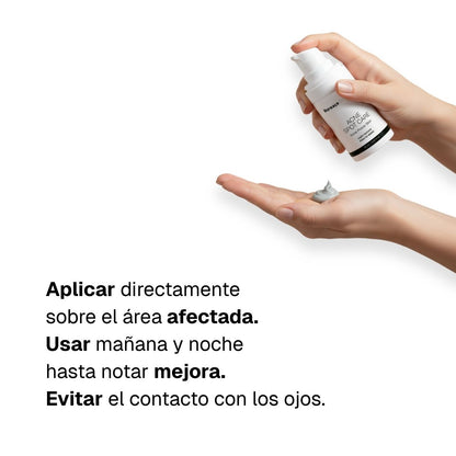 Tratamiento localizado anti-acné
