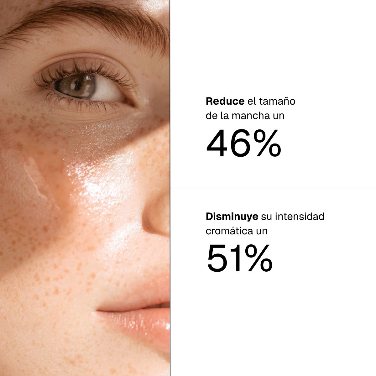 Tratamiento Manchas Localizado 1% Ácido Kójico